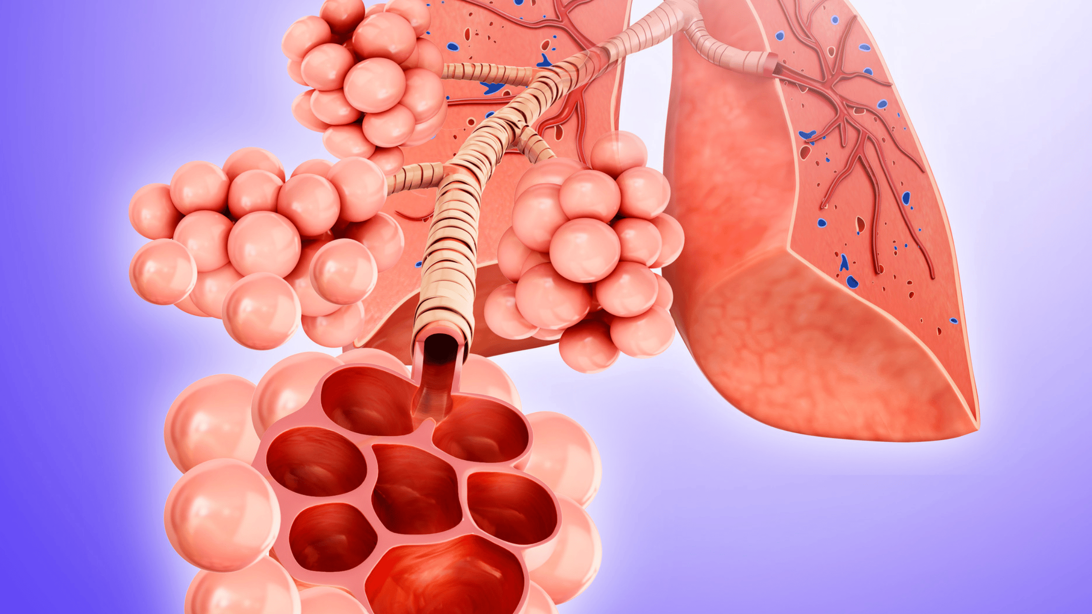 Alveoli Atelectasis nclex prep-1