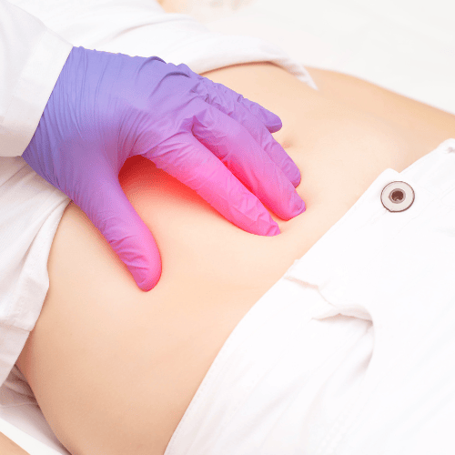 Appendicitis – Assessment Nursing Mnemonic