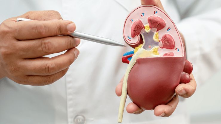 Chronic Kidney Disease nclex prep