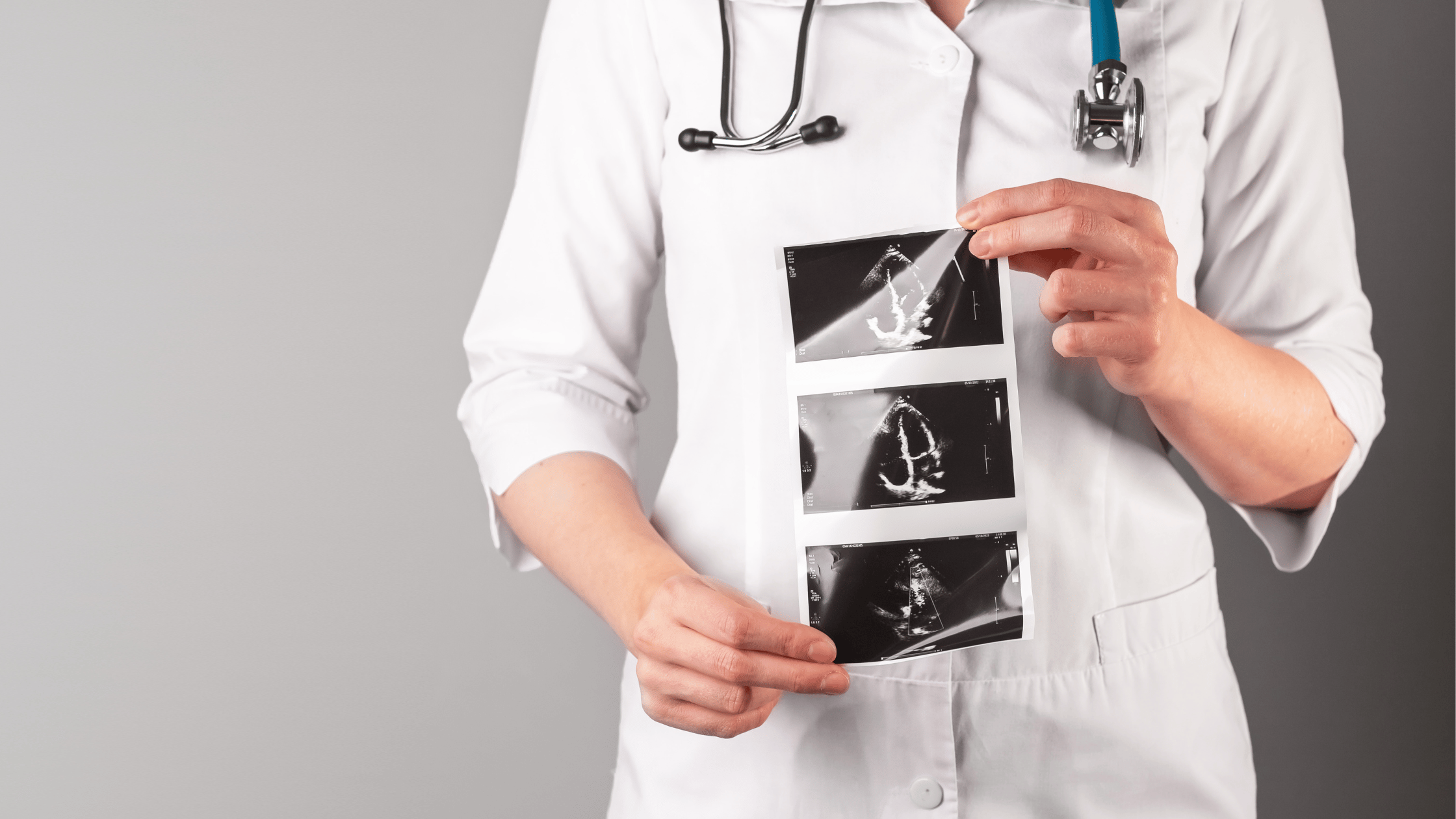 Congenital Heart Defects nursing care plan