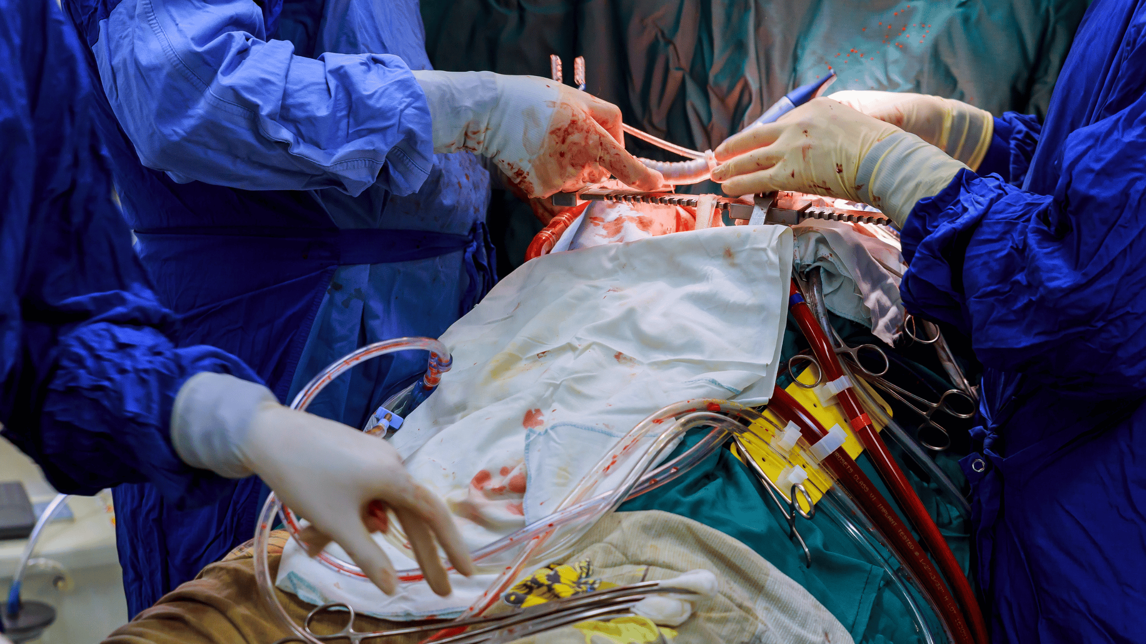 Coronary Artery Disease nclex prep
