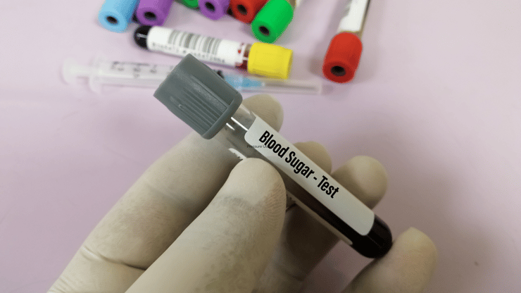 Diabetes Insipidus nclex prep