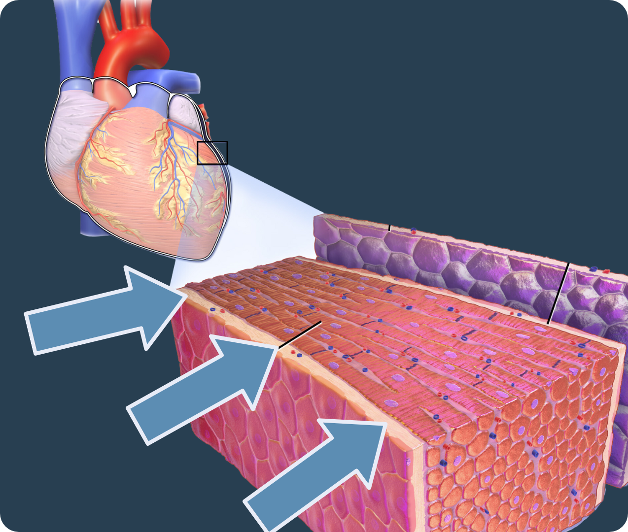 Endocardium-modified
