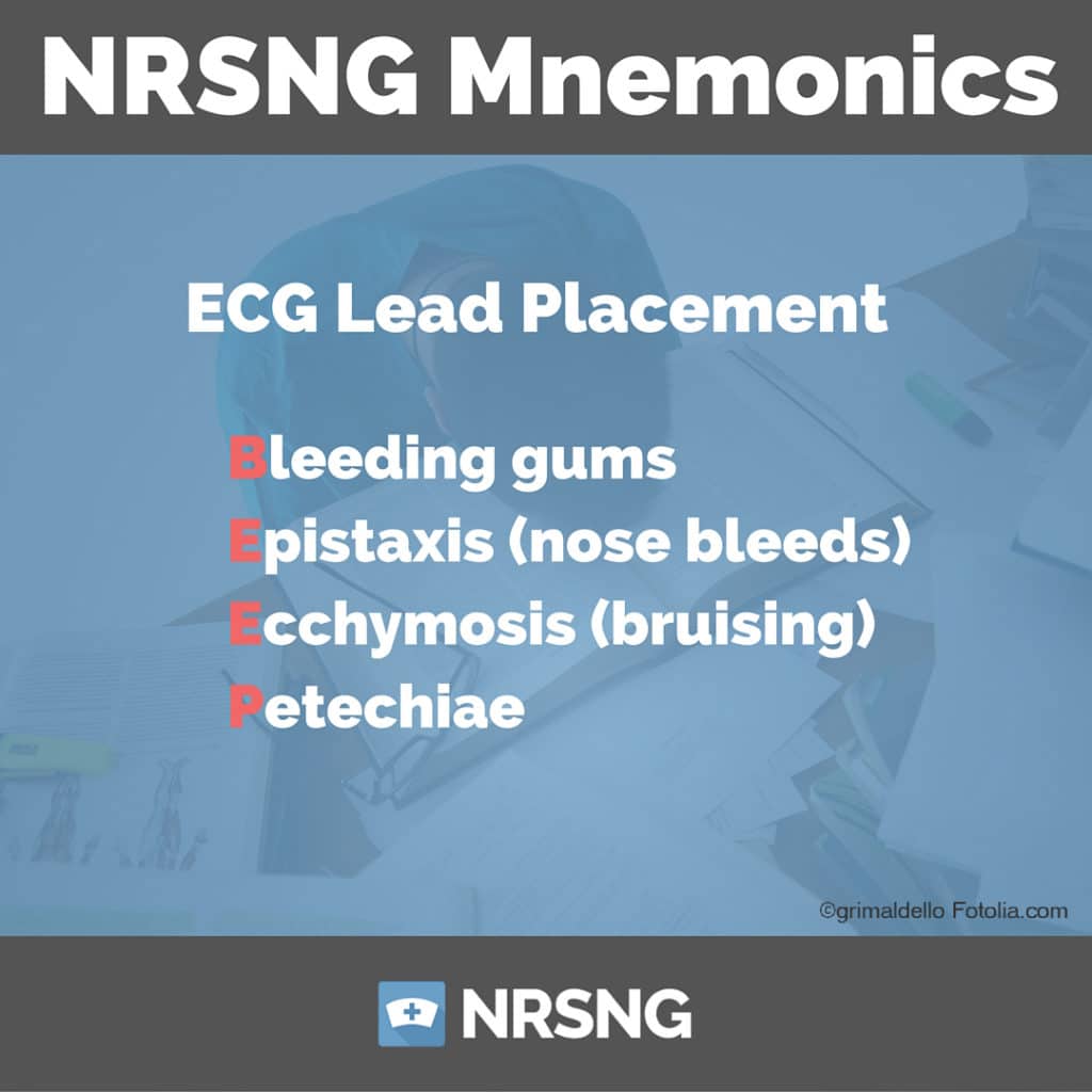 ecg lead placement