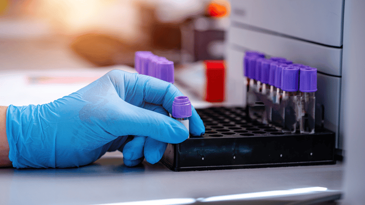 Leukemia nclex review