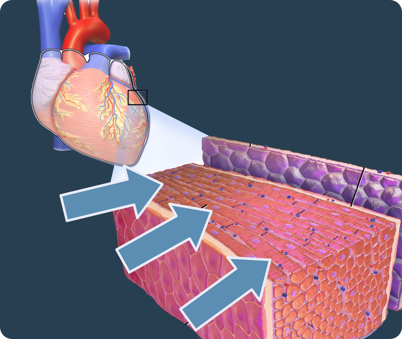 Myocardium-modified