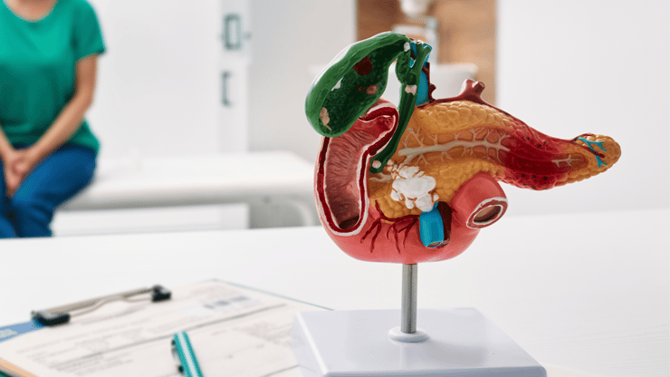 Pancreatitis nclex prep