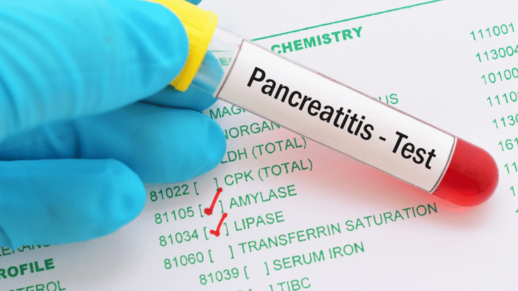 Pancreatitis nclex review