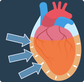 Pericardial Sac