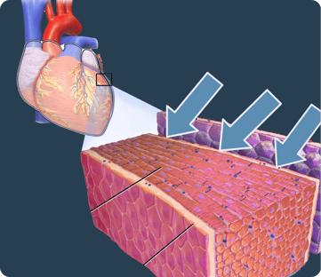 Pericardium-modified