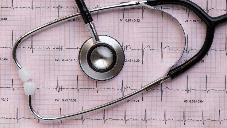sinus tachycardia nclex review