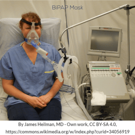 BiPAP Mask
